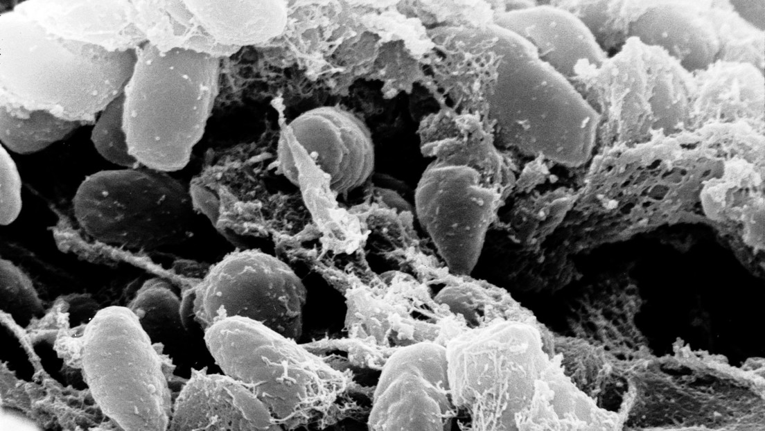 A 10-year-old girl dies of bubonic plague in Colorado