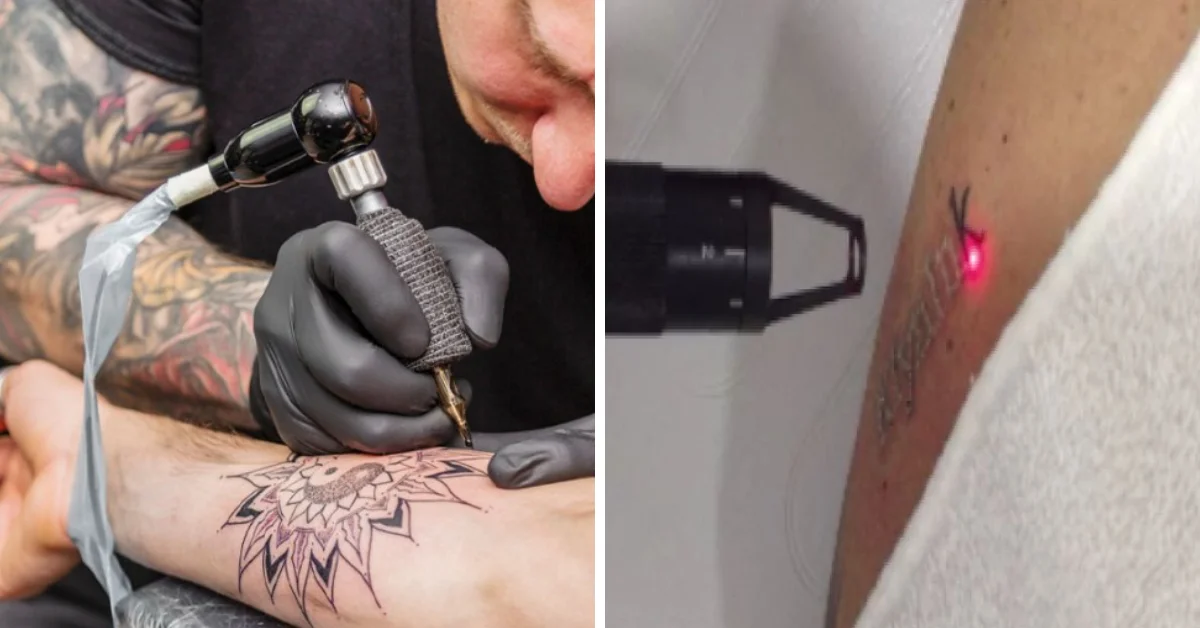 Find out if it’s better for your health to erase or cover up tattoos