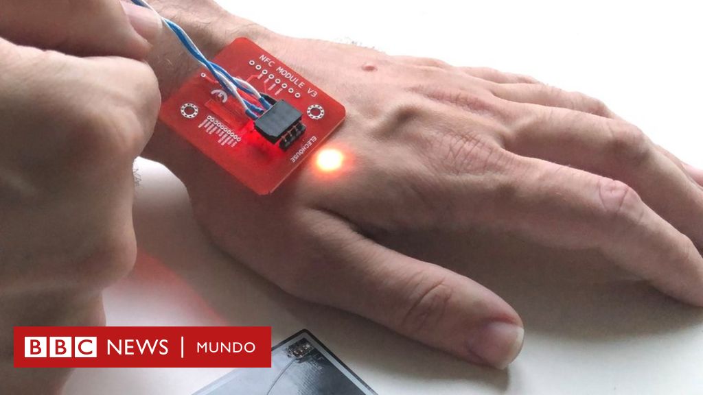 Microchip implants that allow you to push with your hand